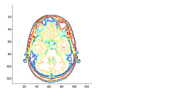 Defining Isosurfaces Using Contour Details 